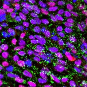 Immunofluorescent image of iPSC line generated from a Parkinson's patient labeled with DSHB antibody MC-813-70 (SSEA-4) against stage-specific embryonic antigen 4 (green). PMID: 32305865, Fig. 1C.